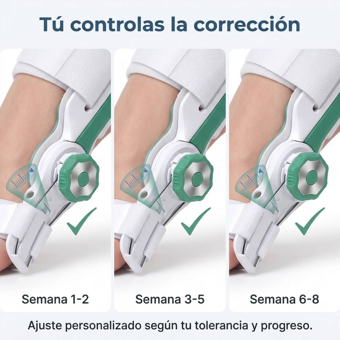Corrige tus juanetes en 8 semanas sin cirugía, sin dolor y sin que nadie lo note